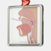SpiegelLaryngoscopy Silbernes Ornament (Links)