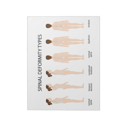 Spinal-Deformationstypen Notizblock (Rotiert)