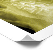 Spinal Degeneration Cervical Spine Chiropractic Poster (Ecke)