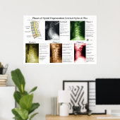 Spinal Degeneration Cervical Spine Chiropractic Poster (Heimbüro)