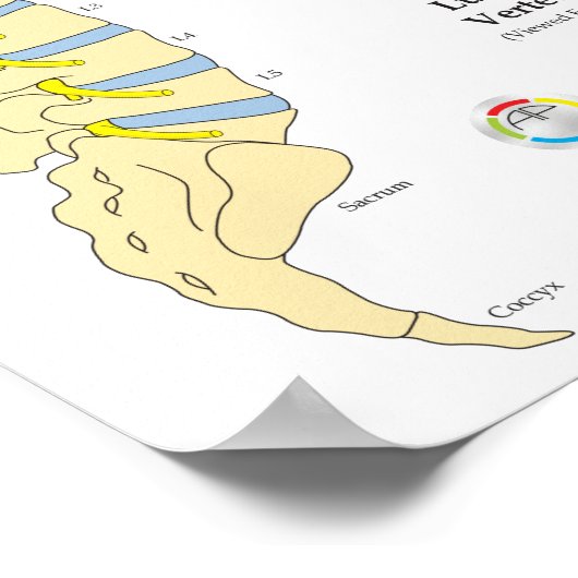 Spinal Degeneration Disk Herniation Poster (Ecke)