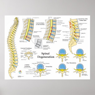 Spinal Degeneration Disk Herniation Poster
