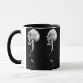 Spinal stechen Sie an Tasse (Links)