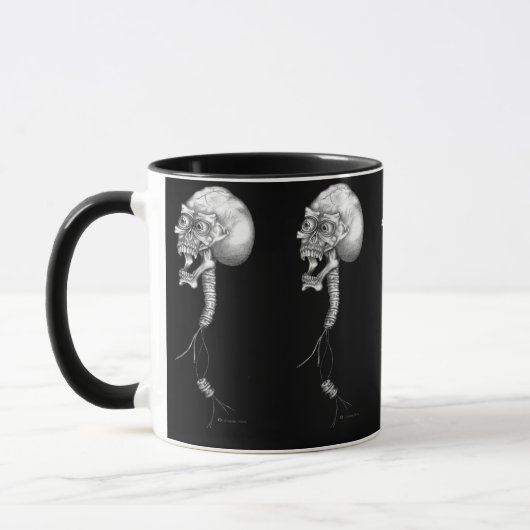 Spinal stechen Sie an Tasse (Links)