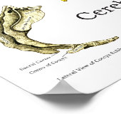 Spinale Nerven Chiropraktische Subluxationen Poster (Ecke)