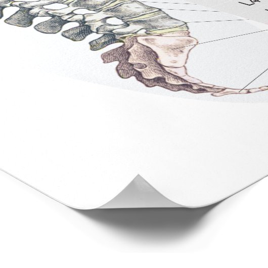 Spinale Subluxation Chiropraktische Effekte Poster (Ecke)