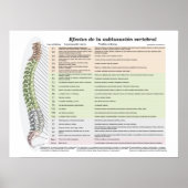 Spinale Subluxation Chiropraktische Effekte Poster (Vorne)