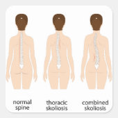 Spinalfehler Quadratischer Aufkleber (Vorderseite)