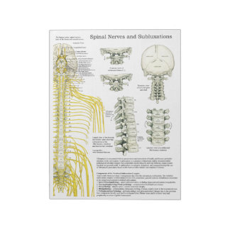 SpinalNerven-Subluxation reißt die Pads ab Notizblock