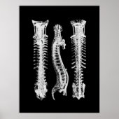 Spine Anatomie Art Poster (Vorne)