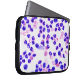 Staph Laptopschutzhülle (Vorne Rechts)