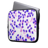 Staph Laptopschutzhülle (Vorderseite Links)