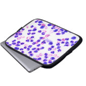 Staph Laptopschutzhülle (Vorne Knopf)