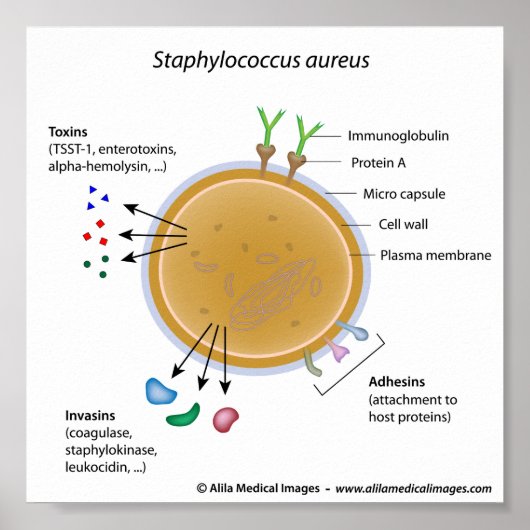 Staphylococcus aureus bakterienbeschriftetes Diagr Poster (Vorne)