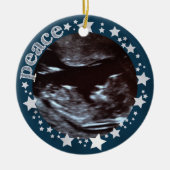 Sterne u. Freude! Sonogram-erste Keramikornament (Vorne)