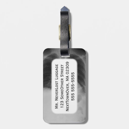 Strahl ~ Gepäckanhänger des Kasten-X (Rückseite vertikal)