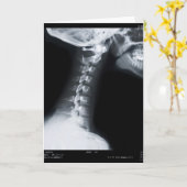 Strahl X der Halswirbel einschließlich unteren Karte (Gelbe Blume)