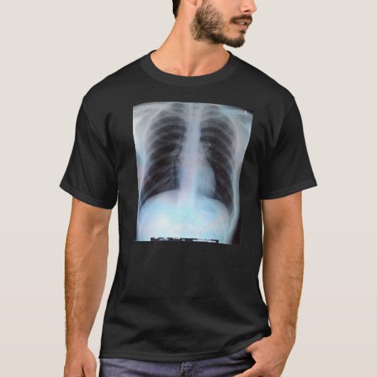Strahln-T - Shirt des Kasten-X (Vorderseite)