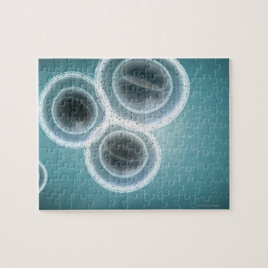 Struktur der MRSA Puzzle (Horizontal)