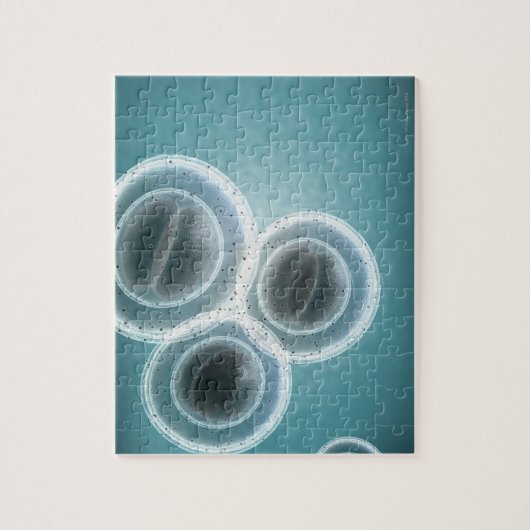 Struktur der MRSA Puzzle (Vertikal)