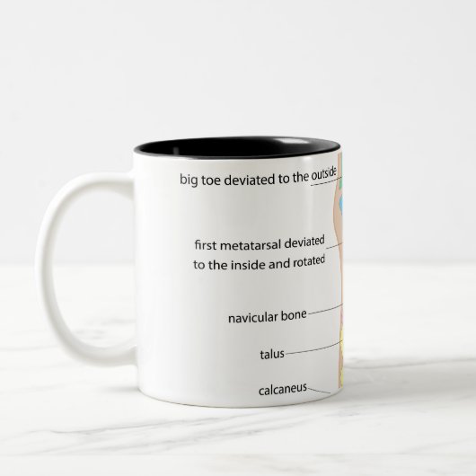 Struktur des menschlichen Fußes Zweifarbige Tasse (Links)