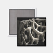Struktur eines Knochens mit Osteoporose Magnet (Vorderseite/Rückseite)