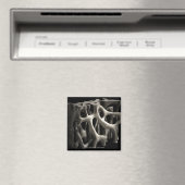 Struktur eines Knochens mit Osteoporose Magnet (In Situ (Geschirrspüler))