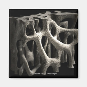 Struktur eines Knochens mit Osteoporose Magnet