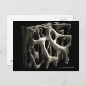 Struktur eines Knochens mit Osteoporose Postkarte (Vorne/Hinten)