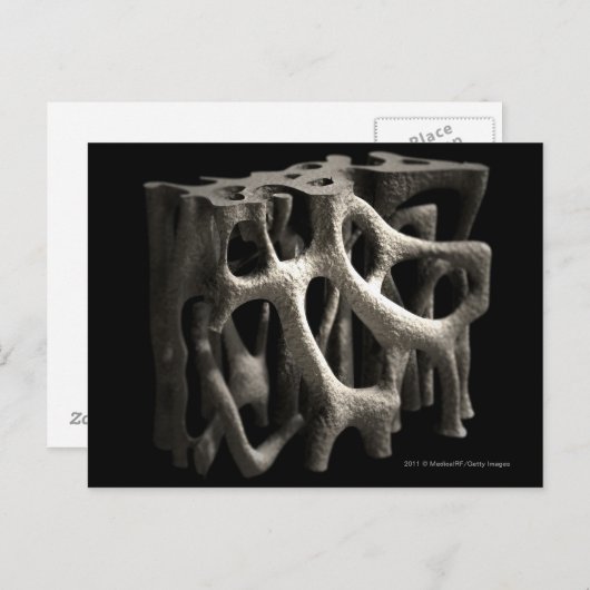 Struktur eines Knochens mit Osteoporose Postkarte (Vorne/Hinten)