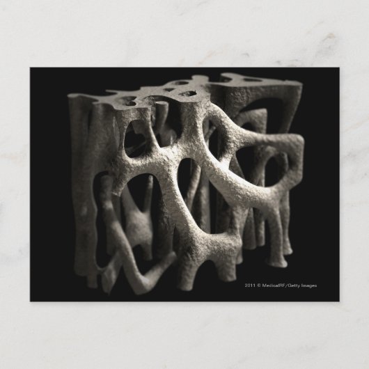 Struktur eines Knochens mit Osteoporose Postkarte (Vorderseite)