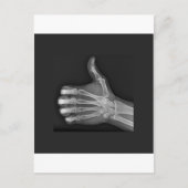 Stupf Postkarte (Vorderseite)