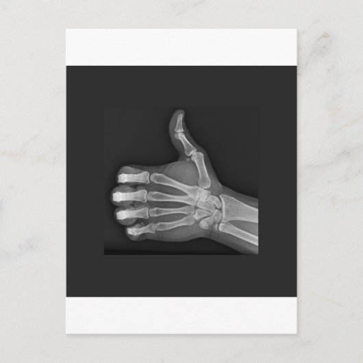 Stupf Postkarte (Vorderseite)