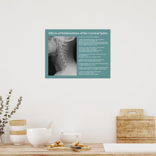 Subluxation Effekte Wirbelsäule Chiropraktik Poster (Küche)
