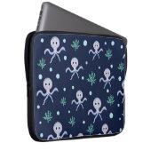 Süßes Octopus-Muster Laptopschutzhülle (Vorne Rechts)