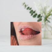 Süßigkeiten, Zuckerlippen Postkarte (Stehend Vorderseite)