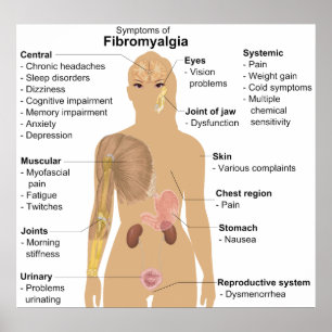 Symptomatik der Fibromyalgie Poster