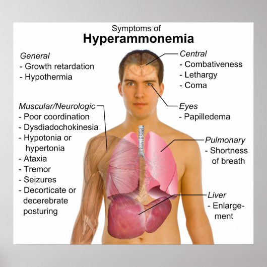 Symptomatik der Stoffwechselerkrankung Hyperammonä Poster (Vorne)