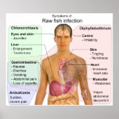 Symptomatik einer Infektion mit rohen Fischen Poster (Vorne)