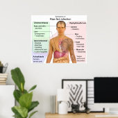 Symptomatik einer Infektion mit rohen Fischen Poster (Heimbüro)