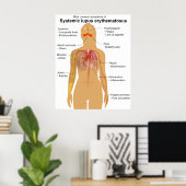 Symptomdiagramm des systemischen Lupus Erythematod Poster (Heimbüro)