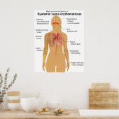 Symptomdiagramm des systemischen Lupus Erythematod Poster (Küche)
