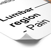 Symptome einer akuten hämolytischen Transfusionsre Poster (Ecke)