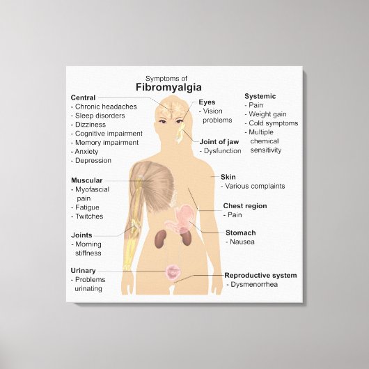 Symptome Fibromyalgie Canvas Print Leinwanddruck (Vorderseite)