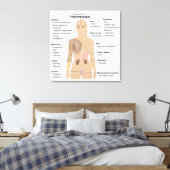 Symptome Fibromyalgie Canvas Print Leinwanddruck (Insitu (Schlafzimmer))