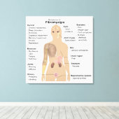 Symptome Fibromyalgie Canvas Print Leinwanddruck (Insitu (Holzboden))
