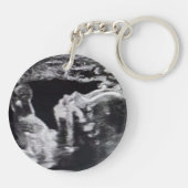 Tante | Geburtsankündigung | Ultraschall Schlüsselanhänger (Rückseite)