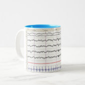 Tasse des Schlaf-EEG - Schlaf der Bühne-2 (Vorderseite Links)