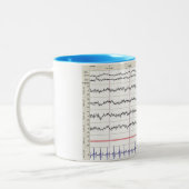 Tasse des Schlaf-EEG - Schlaf der Bühne-2 (Links)