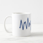 Tasse ER EKG (Links)